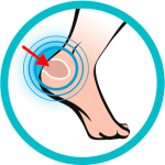 Foot Protector - Heel Protectors